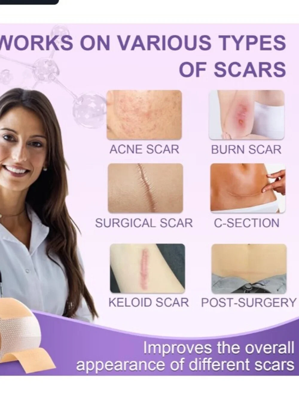 Silicone Scar Sheets, Advanced Medical Silicone Scar Tape(1.6